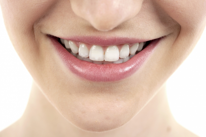 Med tannbleking kan dine tenner skinne som smykker